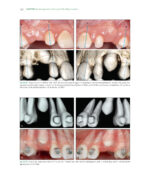 The Ortho-Perio Patient: Clinical Evidence and Therapeutic Guidelines 2019 - Image 2