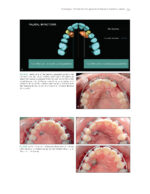 The Ortho-Perio Patient: Clinical Evidence and Therapeutic Guidelines 2019 - Image 3
