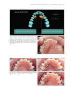 The Ortho-Perio Patient: Clinical Evidence and Therapeutic Guidelines 2019 - Image 3