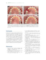 The Ortho-Perio Patient: Clinical Evidence and Therapeutic Guidelines 2019 - Image 4