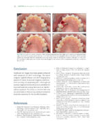 The Ortho-Perio Patient: Clinical Evidence and Therapeutic Guidelines 2019 - Image 4