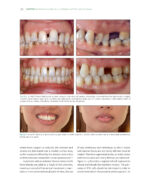 The Ortho-Perio Patient: Clinical Evidence and Therapeutic Guidelines 2019 - Image 5
