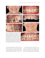 The Ortho-Perio Patient: Clinical Evidence and Therapeutic Guidelines 2019 - Image 6