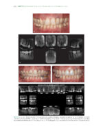 The Ortho-Perio Patient: Clinical Evidence and Therapeutic Guidelines 2019 - Image 8