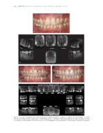 The Ortho-Perio Patient: Clinical Evidence and Therapeutic Guidelines 2019 - Image 8