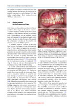 Craniofacial Pain: Temporomandibular Disorders and Beyond 2024 - Image 8