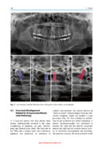 Craniofacial Pain: Temporomandibular Disorders and Beyond 2024 - Image 3