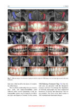 Craniofacial Pain: Temporomandibular Disorders and Beyond 2024 - Image 2