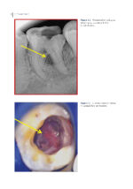 Clinical Atlas of Retreatment in Endodontics 2021 - Image 2