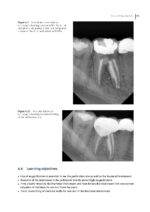 Clinical Atlas of Retreatment in Endodontics 2021 - Image 4