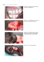 Clinical Atlas of Retreatment in Endodontics 2021 - Image 12