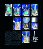 RESTORING THE INTRARADICULAR SPACE: ESTHETIC POST SYSTEMS 2021 - Image 6