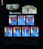 RESTORING THE INTRARADICULAR SPACE: ESTHETIC POST SYSTEMS 2021 - Image 7