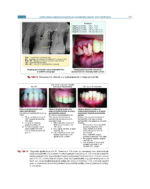 Textbook of Periodontology: for Undergraduate Students 2025 - Image 5