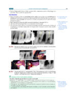 Textbook of Periodontology: for Undergraduate Students 2025 - Image 12