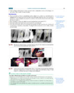 Textbook of Periodontology: for Undergraduate Students 2025 - Image 12