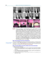 Textbook of Periodontology: for Undergraduate Students 2025 - Image 14