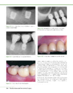 PRACTICAL ADVANCED PERIODONTAL SURGERY 2020 - Image 12