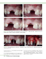 PRACTICAL ADVANCED PERIODONTAL SURGERY 2020 - Image 4