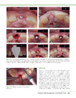 PRACTICAL ADVANCED PERIODONTAL SURGERY 2020 - Image 6