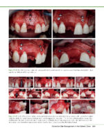 PRACTICAL ADVANCED PERIODONTAL SURGERY 2020 - Image 7