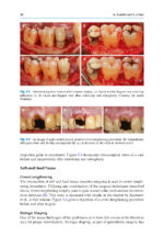 Advances in Periodontal Surgery: A Clinical Guide to Techniques and Interdisciplinary Approaches 2020 - Image 5