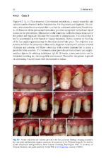 Advances in Periodontal Surgery: A Clinical Guide to Techniques and Interdisciplinary Approaches 2020 - Image 6