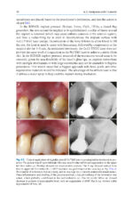 Advances in Periodontal Surgery: A Clinical Guide to Techniques and Interdisciplinary Approaches 2020 - Image 7