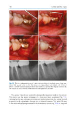 Advances in Periodontal Surgery: A Clinical Guide to Techniques and Interdisciplinary Approaches 2020 - Image 8