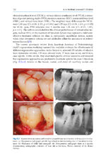 Advances in Periodontal Surgery: A Clinical Guide to Techniques and Interdisciplinary Approaches 2020 - Image 9