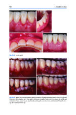 Advances in Periodontal Surgery: A Clinical Guide to Techniques and Interdisciplinary Approaches 2020 - Image 10