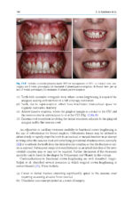Advances in Periodontal Surgery: A Clinical Guide to Techniques and Interdisciplinary Approaches 2020 - Image 11