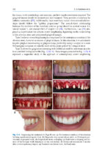 Advances in Periodontal Surgery: A Clinical Guide to Techniques and Interdisciplinary Approaches 2020 - Image 2