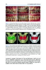 Advances in Periodontal Surgery: A Clinical Guide to Techniques and Interdisciplinary Approaches 2020 - Image 3