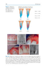 Advances in Periodontal Surgery: A Clinical Guide to Techniques and Interdisciplinary Approaches 2020 - Image 4