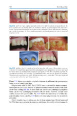 Digitization in Dentistry: Clinical Applications 2021 - Image 2