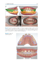 Digitization in Dentistry: Clinical Applications 2021 - Image 3