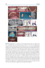 Digitization in Dentistry: Clinical Applications 2021 - Image 4