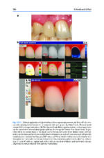Digitization in Dentistry: Clinical Applications 2021 - Image 6