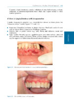 Oral Medicine and Medically Complex Patients 2025 - Image 12