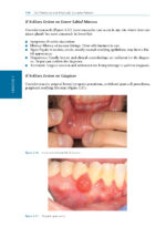 Oral Medicine and Medically Complex Patients 2025 - Image 13