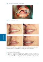 Oral Medicine and Medically Complex Patients 2025 - Image 4