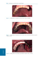 Oral Medicine and Medically Complex Patients 2025 - Image 5