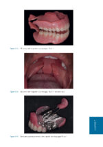 Oral Medicine and Medically Complex Patients 2025 - Image 6