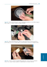 Oral Medicine and Medically Complex Patients 2025 - Image 10