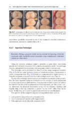 Direct Restorations: Clinical Steps for Working Protocols 2024 - Image 3
