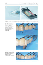 Direct Restorations: Clinical Steps for Working Protocols 2024 - Image 4