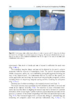 Direct Restorations: Clinical Steps for Working Protocols 2024 - Image 5