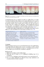 Direct Restorations: Clinical Steps for Working Protocols 2024 - Image 9