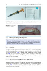 Direct Restorations: Clinical Steps for Working Protocols 2024 - Image 10